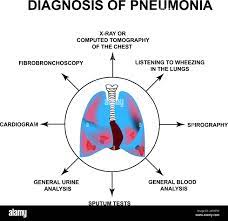 Diagnosis Of Pneumonia. Human Respiratory Organs. World Pneumonia Day. The  Anatomical Structure Of Inflamed Lungs. Infographics. Vector Illustration  Stock Vector Image & Art - Alamy