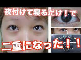 streetrend 顔 変わる 蒙古ひだ がる