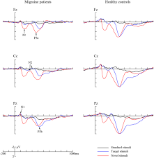 Integritas kelembagaan petani gapoktan dan p3a 91 (property rights); The Impact Of Attack Frequency And Duration On Neurocognitive Processing In Migraine Sufferers Evidence From Event Related Potentials Using A Modified Oddball Paradigm Bmc Neurology Full Text