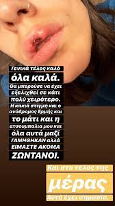 Maybe you would like to learn more about one of these? Atyxhma Gia Thn Anna Maria Bellh Paramorfw8hkan Ta Xeilh Ths Pics Ydrogeios 106 9 Fm