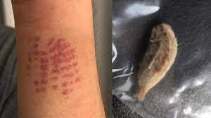 Maybe you would like to learn more about one of these? Land O Lakes Mom Sends Warning After Son Stung By Venomous Caterpillar
