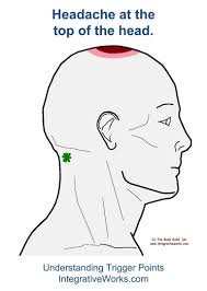 Pin On Acupressure