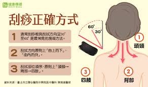 本來老婆都要我幫忙 手動方式刮痧 , 用手打換不同拔罐方式 只是會很累, 後來覺得應該有電 連結 回報 推薦 只看樓主 列印. ä¸­æš'åˆ®ç—§çœ‰è§'å¤šä¸­é†«å¸« éžè¶Šç—›è¶Šæœ‰æ•ˆ ä»Šå'¨åˆŠ