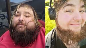 Lower Hutt man Eli Moon loses 138kg to transform his life after near-death  experience : r/newzealand