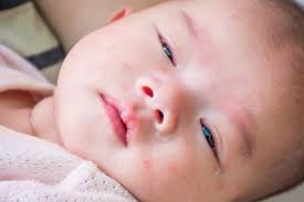 We did not find results for: Halaman Download Kenali 9 Penyebab Bintik Merah Pada Bayi Agar Obatnya Tepat