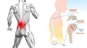 Pin On Health Issues