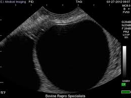 Image result for corpus luteum sonography)