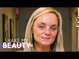 My Ex Disfigured My Face