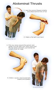 Chocking First Aid Tips Bing Images Emergency Medical First Aid First Aid Procedures