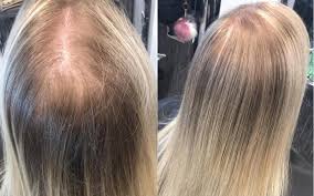 If you have very fine hair, it's easy to feel like you're limited with the hairstyles that you can work with. What Are The Best Hairstyles For Very Thin Hair Hair Adviser Hairstyles For Thin Hair Long Thin Hair Thin Fine Hair