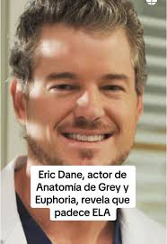 Eric Singer Dialect Actors