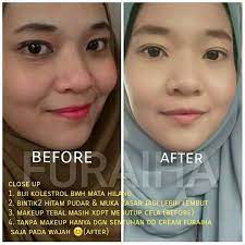 Adapun, saponin yang ada dalam biji betik bermanfaat untuk menurunkan aktiviti kolesterol serum seperti aksi resin, iaitu dengan. Biji Kolestrol Tanda Furaiha The Best Organic Skincare Facebook