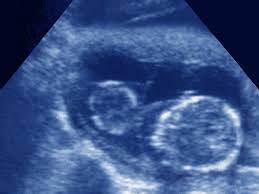 Actively scan device characteristics for identification. Anomaly Scan 20 Weeks Babycentre Uk