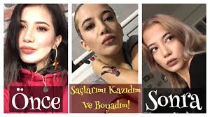 Siyah Boyali Saclarimi Nasil Actim Youtube
