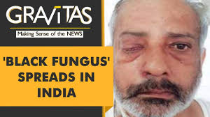 It has to be distinguished from the related counterpart invasive pulmonary. Gravitas What Is Black Fungus Or Mucormycosis Youtube