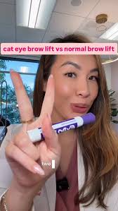 Not all brow lifts are created equal 👀💉, ➡️ Cat Eye Lift: Botox at the  tail of the brows for that sleek, lifted look., ➡️ Traditional Lift: A  higher arch by relaxing less of the forehead which lets ...