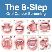 Image result for gums cancer symptoms