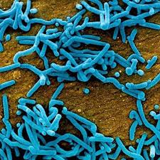 El virus del ébola 1 (ebolavirus) 2 es un género de virus de la familia filoviridae que se detectó por primera vez en algunas regiones de áfrica. Wgylsylzl6lurm