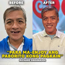 Ang perfect smile? Achieved! 👏🏻 Transformation is real dahil sa tulong ng  Real Herrera Dental Clinic na-achieve nila ang kanilang perfect smile! ❤️