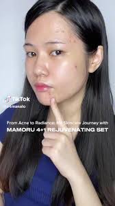 #MamaoruRejuvMadamKilay