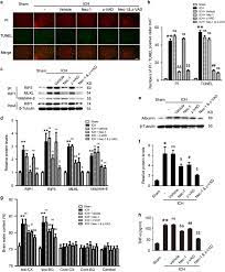 Role For Rip1 In Mediating Necroptosis In Experimental Intracerebral Hemorrhage Model Both In Vivo And In Vitro Cell Death Disease