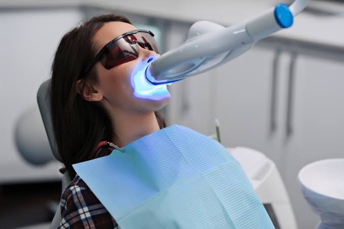 Blanqueamiento Dental