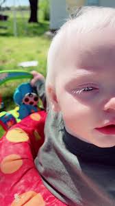 Beautiful White Hair Baby