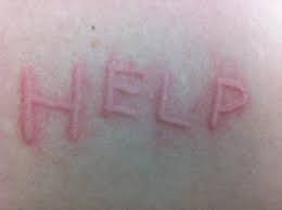 Urticaria corona
