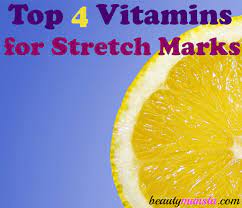 Top 4 Vitamins To Prevent Stretch Marks Beautymunsta Free Natural Beauty Hacks And More