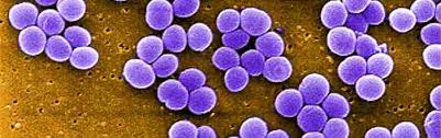 I disturbi causati nella maggior parte dei casi non sono però particolarmente intensi e possono scatenarsi dopo anni dall'esposizione all'infezione. Infezioni Da Stafilococco Dalla Prevenzione Al Trattamento