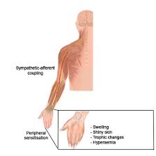 Image result for Pain Disorder