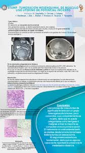 Stump - Tumoración Mesenquinal de Musculo Liso Uterino de Potencia Incierto
