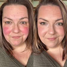 I like Chanterelle/Lily/Anne, but this makeup is 😬