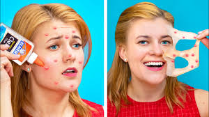 The best gifs are on giphy. Facons Etranges De Se Debarrasser Des Boutons 18 Astuces Amusantes Youtube