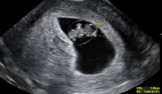 El primer ultrasonido de nuestro bebe 9. Semana 7 De Embarazo Inatal El Embarazo Semana A Semana