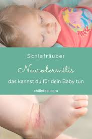 Beikost für babys mit neurodermitis. 52 Neurodermitis Bei Kindern Ideen Neurodermitis Neurodermitis Kinder Neurodermitis Ernahrung