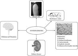 Image result for Hypernatremia
