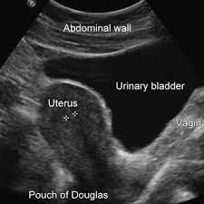Maybe you would like to learn more about one of these? Pdf Pelvic Ultrasound Simulation Training Models And Case Scenarios