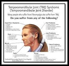 Pin By Joe Pugh On Fibromyalgie Symptomes Tmj Headache Temporomandibular Joint Tmj