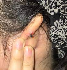 Help Infected 1 Year Old Helix Piercing Now What Piercing