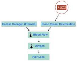 Latisse) and latanoprost are pgf2a analogs. Prostaglandin D2 Miracle Hair Loss Discovery Or Just Another Sign Of Inflammation Perfect Hair Health