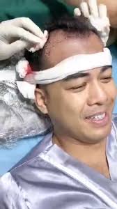 Wow ប្រ៉ូម៉ូសិនពិសេសមែនទែនបងបង 👏👏👏, ព័មានបន្ថែម ☎️098633326, ប្រ៉ូម៉ូសិន  1+1 , 👉1000គុម្ព 798$ ថែមជូន100គុម្ព ថែមPRP 2 ដង, 👉2000គុម្ព 1596$ថែមជូន  200គុម្ព PRP ថែម 3 ដង , 👉3000គុម្ព 2394$ ថែមជូន 300 ...