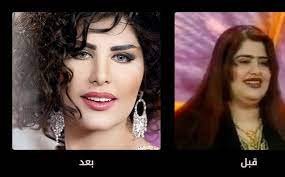 كما وضحت أن فيلم مش أنا كان قد صور قبل فترة طويلة ولا يمثلها خاصة بعد زواجها. ØµÙˆØ± Ù…Ø´Ø§Ù‡ÙŠØ± Ø¹Ø±Ø¨ÙŠØ§Øª Ù‚Ø¨Ù„ ÙˆØ¨Ø¹Ø¯ Ø¹Ù…Ù„ÙŠØ§Øª Ø§Ù„ØªØ¬Ù…ÙŠÙ„ 3a2ilati