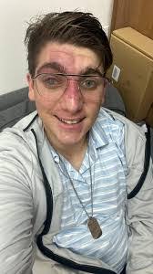 Aaron Peker's Instagram, Twitter & Facebook