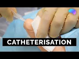 Image result for Urethral Catheterization