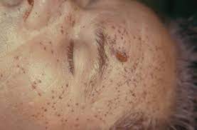 Maybe you would like to learn more about one of these? Forensic Pathology