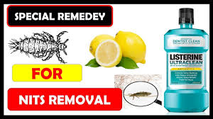 How To Remove Lice And Nits From Hair Permanently Home Remedies That D Home Remedies For Hair Lice Removal Nits Removal Now it's in your home and it's up to you to find the best way to get rid of them.