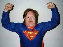 Treatment For Down Syndrome Mccluskey Down Syndrome
