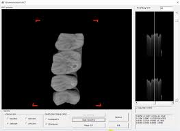 Playerunknown's battlegrounds (pubg) is a competitive survival shooter. Wide Field Of View Optical Coherence Tomography For Structural And Functional Diagnoses In Dentistry