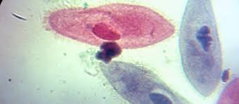 Under The Microscope: Paramecium | Office for Science and Society ...